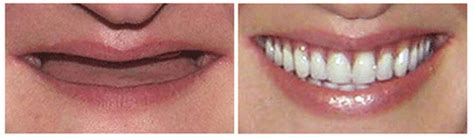 where can i get affordable dentures in ocala florida area